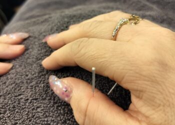 Kirsten Hjorth har klinik Body Well i Tversted og Skagen. Foto: Palle W. Nielsen