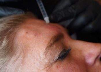 Dr. Wimmer Aesthetics tilbyder mange former for behandling. Pressefoto fra hjemmeside