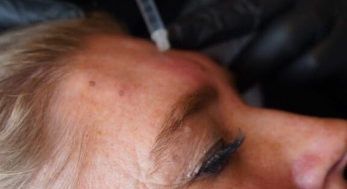 Dr. Wimmer Aesthetics tilbyder mange former for behandling. Pressefoto fra hjemmeside